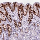Anti-BDKRB2 antibody produced in rabbit Prestige Antibodies® Powered by Atlas Antibodies, affinity isolated antibody, buffered aqueous glycerol solution