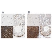Anti-NFKB2 antibody produced in rabbit Prestige Antibodies® Powered by Atlas Antibodies, affinity isolated antibody, buffered aqueous glycerol solution