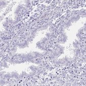 Anti-HDGFL1 antibody produced in rabbit Prestige Antibodies® Powered by Atlas Antibodies, affinity isolated antibody, buffered aqueous glycerol solution