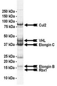 VHL Protein Complex, Active, 10 µg Active complex of five (5) recombinant human enzymes: VHL amino acids 54-end, full length Elongin C, full length Elongin B, full length Cul2, &amp; full length Rbx1. For use in Enzyme Assays. Functions as an E3 ligase in ubiquitination assays.