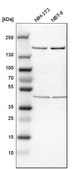 Anti-ROCK1 antibody produced in rabbit Prestige Antibodies® Powered by Atlas Antibodies, affinity isolated antibody, buffered aqueous glycerol solution