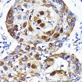 Anti- SQSTM1/p62 antibody produced in rabbit