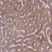 Anti-PAH antibody produced in rabbit Prestige Antibodies® Powered by Atlas Antibodies, affinity isolated antibody, buffered aqueous glycerol solution