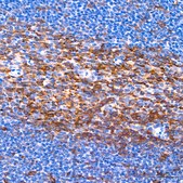 Anti-Muscarinic AChR M2 (ACM2) Antibody, clone 3T5W8, Rabbit Monoclonal
