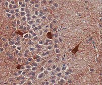 抗-GABAA受体 α1 抗体 Upstate®, from rabbit