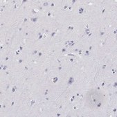 Anti-AKR1B1 antibody produced in rabbit Prestige Antibodies® Powered by Atlas Antibodies, affinity isolated antibody