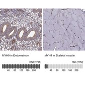 Anti-MYH9 antibody produced in rabbit Prestige Antibodies® Powered by Atlas Antibodies, affinity isolated antibody, buffered aqueous glycerol solution
