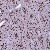 Anti-PARP1 antibody produced in rabbit Prestige Antibodies® Powered by Atlas Antibodies, affinity isolated antibody, buffered aqueous glycerol solution