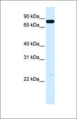 Anti-HGF (ab2) antibody produced in rabbit affinity isolated antibody
