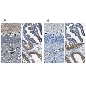 Anti-STIM1 antibody produced in rabbit Prestige Antibodies® Powered by Atlas Antibodies, affinity isolated antibody, buffered aqueous glycerol solution