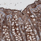 Monoclonal Anti-EZR antibody produced in mouse Prestige Antibodies® Powered by Atlas Antibodies, clone CL2375, purified immunoglobulin, buffered aqueous glycerol solution