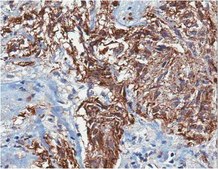 抗巢蛋白，人抗体 serum, from rabbit