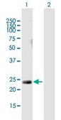 Anti-HRAS antibody produced in mouse purified immunoglobulin, buffered aqueous solution