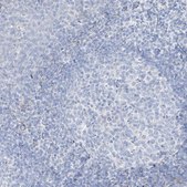 Anti-TGM4 antibody produced in rabbit Prestige Antibodies® Powered by Atlas Antibodies, affinity isolated antibody, buffered aqueous glycerol solution