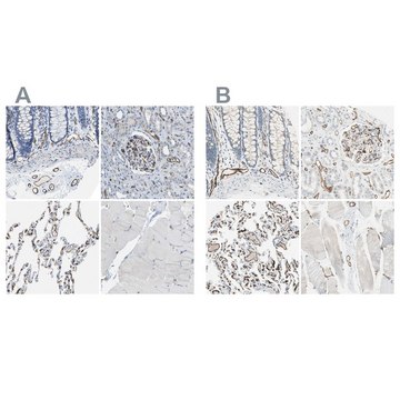 Anti-CD93 antibody produced in rabbit Prestige Antibodies® Powered by Atlas Antibodies, affinity isolated antibody, buffered aqueous glycerol solution