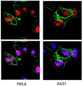 Anti-Ki-67 Antibody, clone Ki-S5 clone Ki-S5, Chemicon®, from mouse