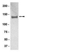 Anti-IRS1 Antibody, clone AW58, rabbit monoclonal culture supernatant, clone AW58, Upstate®
