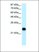 Anti-VDAC2 antibody produced in rabbit affinity isolated antibody
