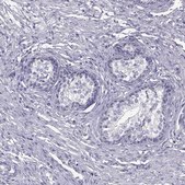 Anti-TNNC1 antibody produced in rabbit Prestige Antibodies® Powered by Atlas Antibodies, affinity isolated antibody