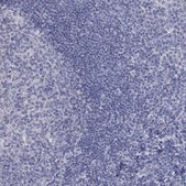 Anti-PTH1R antibody produced in rabbit Prestige Antibodies® Powered by Atlas Antibodies, affinity isolated antibody, buffered aqueous glycerol solution
