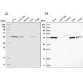 Anti-ALDH5A1 antibody produced in rabbit Prestige Antibodies® Powered by Atlas Antibodies, affinity isolated antibody, buffered aqueous glycerol solution, ab2