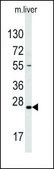 Anti-SOST (N-term) antibody produced in rabbit Ig fraction of antiserum, buffered aqueous solution
