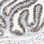 Anti-RNF43 antibody produced in rabbit Prestige Antibodies® Powered by Atlas Antibodies, affinity isolated antibody, buffered aqueous glycerol solution