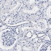 Anti-HLA-DQA1 antibody produced in rabbit Prestige Antibodies® Powered by Atlas Antibodies, affinity isolated antibody, buffered aqueous glycerol solution