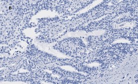 Anti-ATRX Antibody, clone 2A12, ZooMAb® Rabbit Monoclonal recombinant, expressed in HEK 293 cells