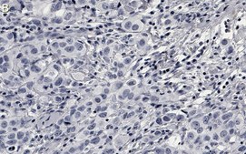 Anti-Phospho-AKT1-(Ser473) Antibody, clone 1O14 ZooMAb® Rabbit Monoclonal recombinant, expressed in HEK 293 cells