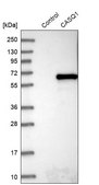 Anti-CASQ1 antibody produced in rabbit Prestige Antibodies® Powered by Atlas Antibodies, affinity isolated antibody, buffered aqueous glycerol solution