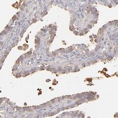 Anti-ABCC4 antibody produced in rabbit Prestige Antibodies® Powered by Atlas Antibodies, affinity isolated antibody, buffered aqueous glycerol solution