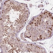 Anti-MGMT antibody produced in rabbit Prestige Antibodies® Powered by Atlas Antibodies, affinity isolated antibody