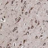 Anti-HSP90B1 antibody produced in rabbit Prestige Antibodies® Powered by Atlas Antibodies, affinity isolated antibody, buffered aqueous glycerol solution