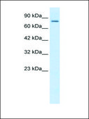 Anti-KCNN3 (AB1) antibody produced in rabbit affinity isolated antibody