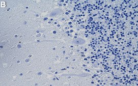 Anti-PKCγ Antibody, clone 2B9 ZooMAb® Rabbit Monoclonal recombinant, expressed in HEK 293 cells