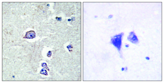 Anti-PDGFR α antibody produced in rabbit affinity isolated antibody