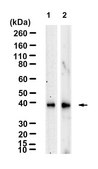 Anti-RANKL/TNFSF11 Antibody, clone 1H17 ZooMAb® Rabbit Monoclonal recombinant, expressed in HEK 293 cells