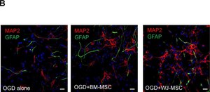 Anti-MAP2 Antibody, clone AP20 clone AP20, Chemicon®, from mouse
