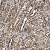 Anti-POLRMT antibody produced in rabbit Prestige Antibodies® Powered by Atlas Antibodies, affinity isolated antibody, buffered aqueous glycerol solution