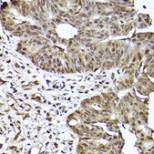 Anti- STAT3 antibody produced in rabbit