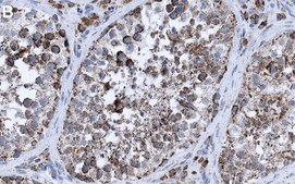 Anti-G3BP1 Antibody, clone 1B10 ZooMAb® Rabbit Monoclonal recombinant, expressed in HEK 293 cells