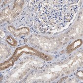 抗-MIF 兔抗 Prestige Antibodies® Powered by Atlas Antibodies, affinity isolated antibody, buffered aqueous glycerol solution