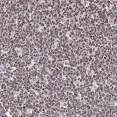 Anti-NKAP antibody produced in rabbit Prestige Antibodies® Powered by Atlas Antibodies, affinity isolated antibody, buffered aqueous glycerol solution