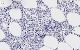 Anti-Myeloperoxidase Antibody, clone 1F8 ZooMAb® Rabbit Monoclonal recombinant, expressed in HEK 293 cells