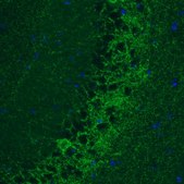Monoclonal Anti-GAD1 antibody produced in mouse Prestige Antibodies® Powered by Atlas Antibodies, clone CL2914, purified immunoglobulin, buffered aqueous glycerol solution