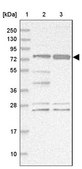 Anti-STIM2 antibody produced in rabbit Prestige Antibodies® Powered by Atlas Antibodies, affinity isolated antibody, buffered aqueous glycerol solution