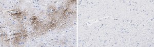 Anti-Aquaporin-4 Antibody, clone 1K2 ZooMAb® Rabbit Monoclonal recombinant, expressed in HEK 293 cells