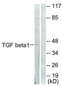 抗 TGFβ1 兔抗 affinity isolated antibody