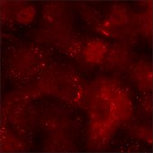 A549 Cells RFP-STAT3